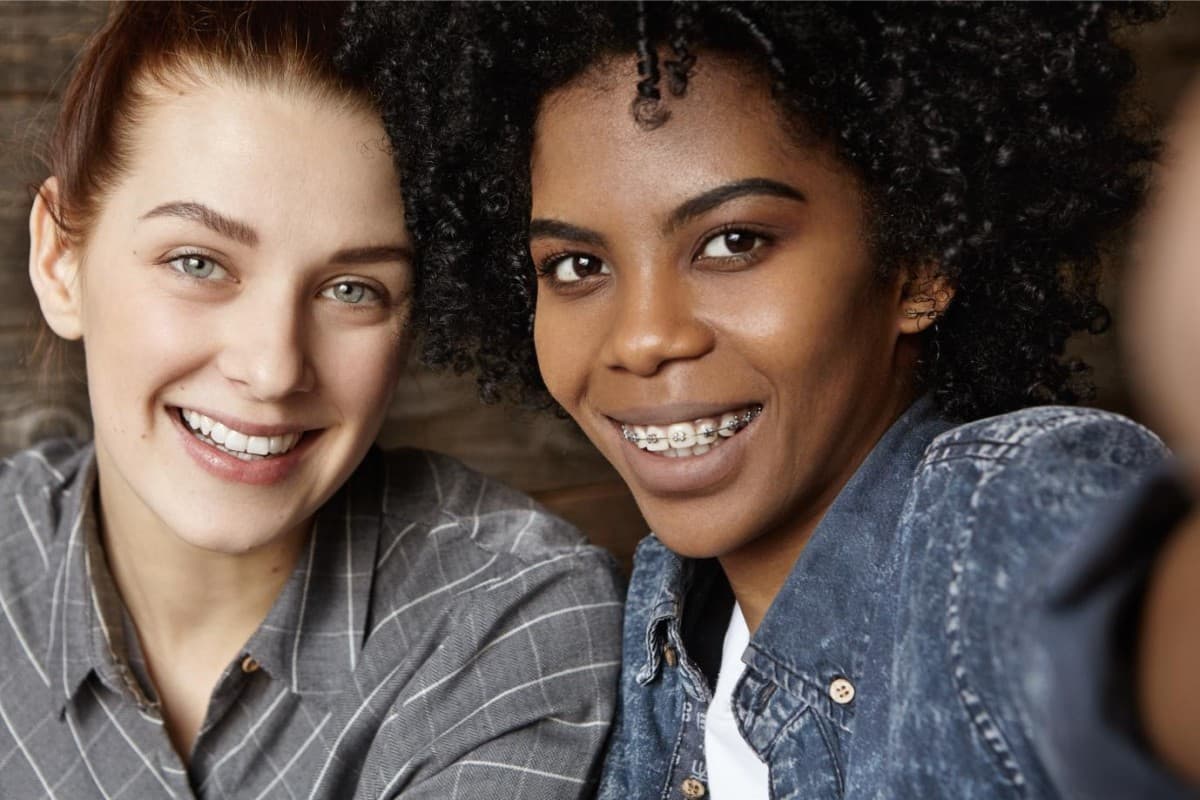 Seacoast Braces / Miller Orthodontics Now Sole Provider of Dynaflex Norris Passive Self-Ligating Braces in Dover and Exeter, NH